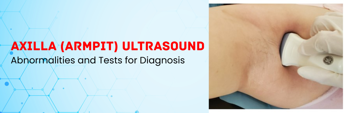 Axilla (Armpit) Abnormalities and Tests for Diagnosis